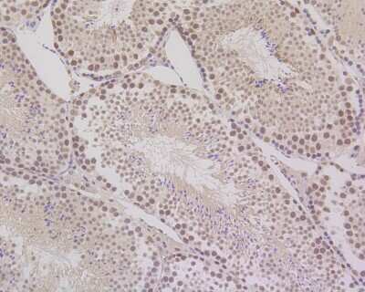 Immunohistochemistry-Paraffin: MLH1 Antibody (SP08-04) [NBP2-67381]