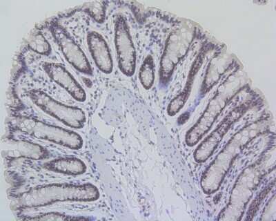 Immunohistochemistry-Paraffin: MLH1 Antibody (SP08-04) [NBP2-67381]