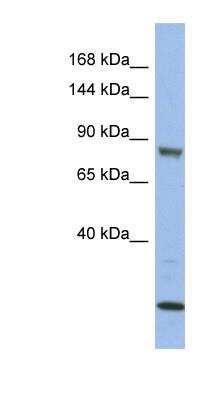Western Blot: MLK3 Antibody [NBP1-58913]
