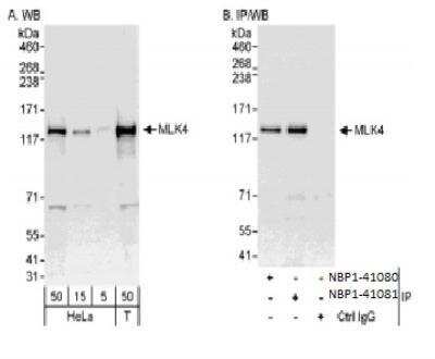 Western Blot: MLK4 Antibody [NBP1-41081]