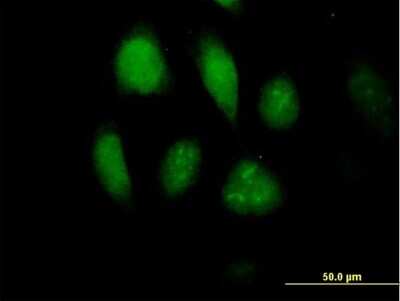 Immunocytochemistry/ Immunofluorescence: MLKL Antibody [H00197259-B01P]