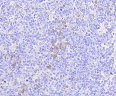 Immunohistochemistry-Paraffin: MLKL Antibody (SA40-04) [NBP2-67299]