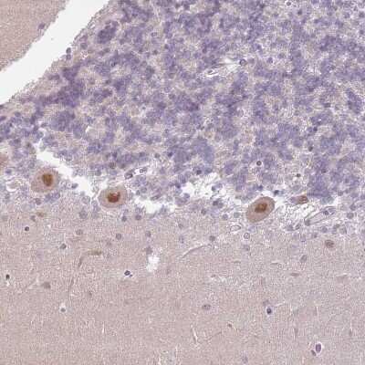 Immunohistochemistry-Paraffin: MLLT11 Antibody [NBP2-14237]