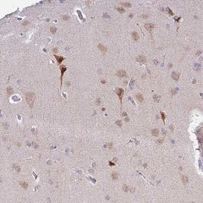 Immunohistochemistry-Paraffin: MLLT11 Antibody [NBP2-14237]