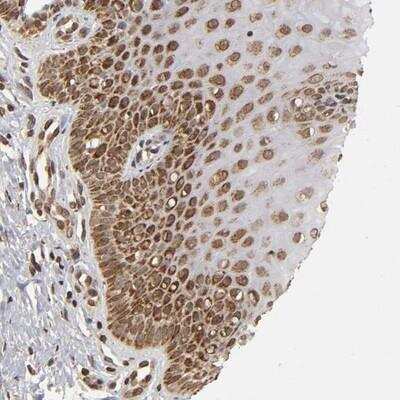 Immunohistochemistry-Paraffin: MLLT6 Antibody [NBP1-89222]