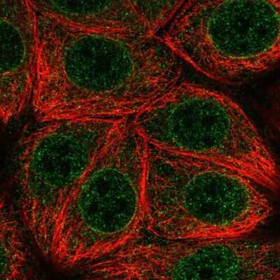 Immunocytochemistry/ Immunofluorescence: MLX Antibody [NBP2-55725]