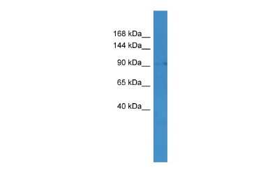 Western Blot: MLXIP Antibody [NBP2-85298]