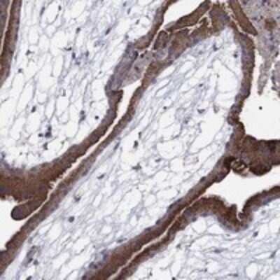 Immunohistochemistry-Paraffin: MMAA Antibody [NBP3-17892]