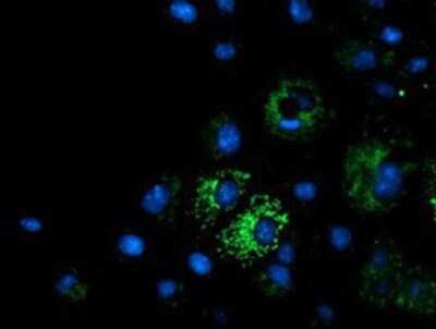 Immunocytochemistry/ Immunofluorescence: MMAA Antibody (OTI3G5) - Azide and BSA Free [NBP2-72726]