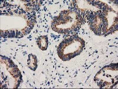 Immunohistochemistry-Paraffin: MMAB Antibody (OTI2G5) [NBP2-03417]