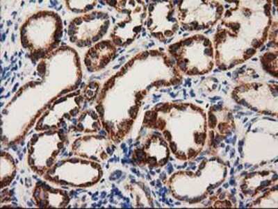Immunohistochemistry-Paraffin: MMAB Antibody (OTI2G5) [NBP2-03417]