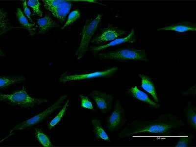Immunocytochemistry/ Immunofluorescence: MMAB Antibody [H00326625-B02P]