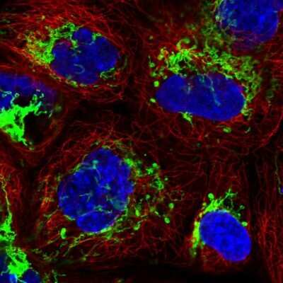 Immunocytochemistry/ Immunofluorescence: MMAB Antibody [NBP1-86602]