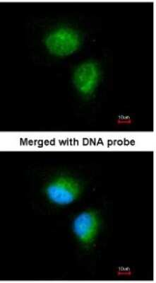 Immunocytochemistry/ Immunofluorescence: MMACHC Antibody [NBP1-32513]