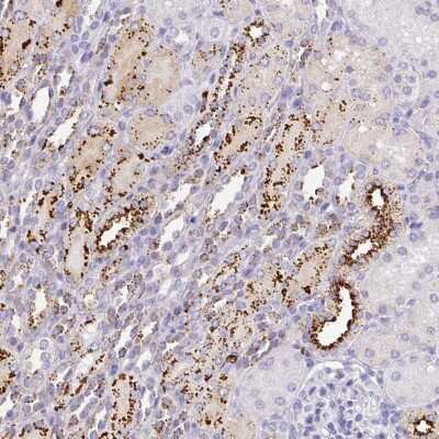 Immunohistochemistry: MMACHC Antibody [NBP2-48582]