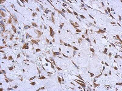 Immunohistochemistry-Paraffin: MMACHC Antibody [NBP1-32513]