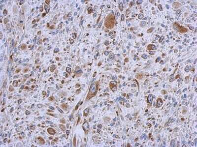 Immunohistochemistry-Paraffin: MMACHC Antibody [NBP1-32513]