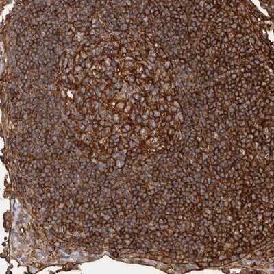 Immunohistochemistry-Paraffin: MMACHC Antibody [NBP1-86597]