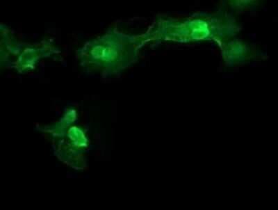 Immunocytochemistry/ Immunofluorescence: MMACHC Antibody (OTI1A4) - Azide and BSA Free [NBP2-72738]