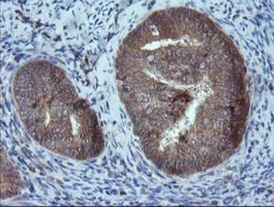 Immunohistochemistry: MMACHC Antibody (OTI1A4) [NBP2-45884]