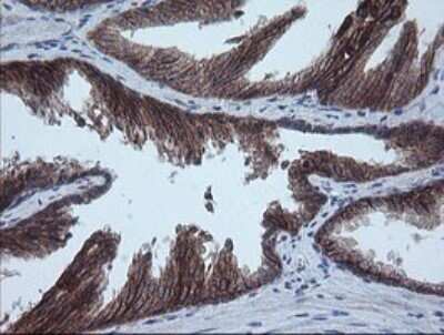 Immunohistochemistry: MMACHC Antibody (OTI1A4) [NBP2-45884]