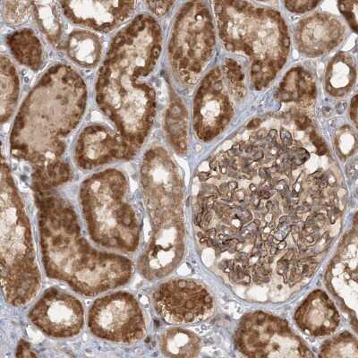 Immunohistochemistry-Paraffin: MMADHC Antibody [NBP2-38351]