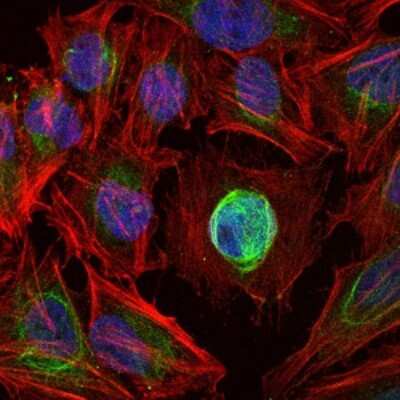 Immunocytochemistry/ Immunofluorescence: MMP-1 Antibody (6A5) - BSA Free [NBP2-22123]