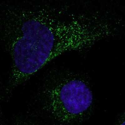 Immunocytochemistry/ Immunofluorescence: MMP-1 Antibody [NBP2-55118]