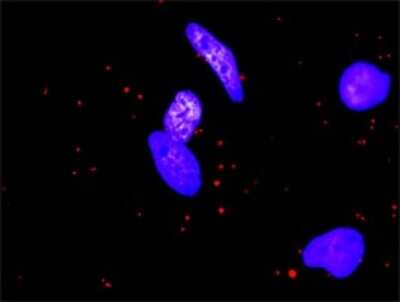 Proximity Ligation Assay: MMP-1 Antibody [H00004312-D01P]