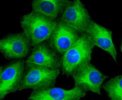 Immunocytochemistry/ Immunofluorescence: MMP-11 Antibody (SN74-08) [NBP2-67670]