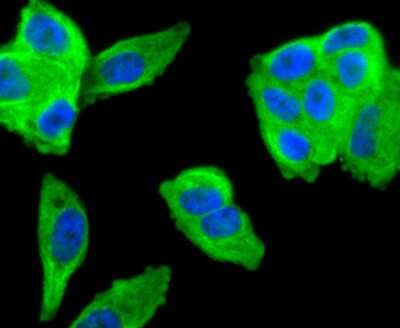 Immunocytochemistry/ Immunofluorescence: MMP-11 Antibody (SN74-08) [NBP2-67670]