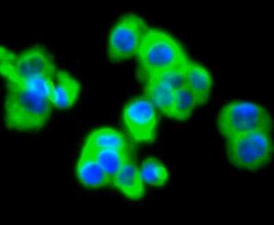 Immunocytochemistry/ Immunofluorescence: MMP-11 Antibody (SN74-08) [NBP2-67670]