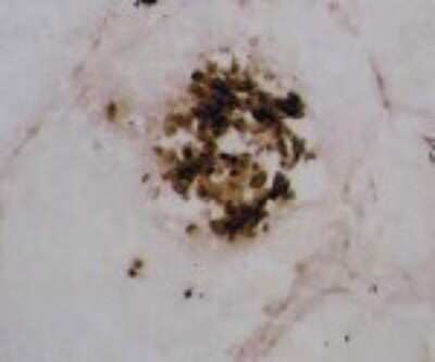 Immunohistochemistry: MMP-12 Antibody (603E6.22) [DDX0280P-100]