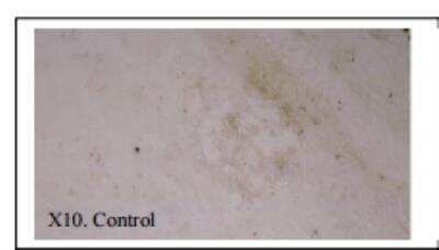 Immunohistochemistry: MMP-12 Antibody (603E6.22) [DDX0280P-100]