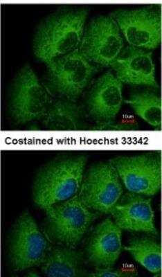 Immunocytochemistry/ Immunofluorescence: MMP-12 Antibody [NBP1-31225]