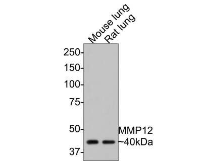 Western Blot: MMP-12 Antibody (SR03-23) [NBP2-67344]