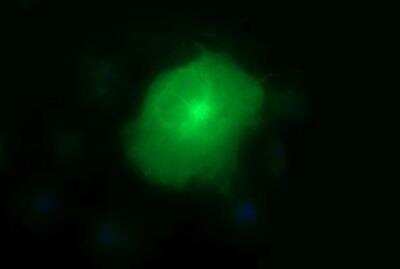 Immunocytochemistry/ Immunofluorescence: MMP-13 Antibody (OTI2D8) [NBP2-45887]