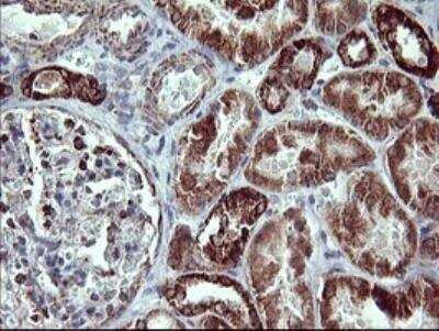 Immunohistochemistry-Paraffin: MMP-13 Antibody (OTI2D8) [NBP2-45887]