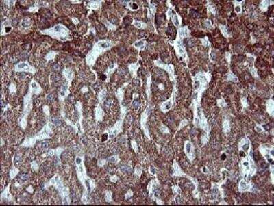 Immunohistochemistry-Paraffin: MMP-13 Antibody (OTI2D8) [NBP2-45887]