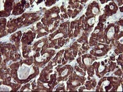 Immunohistochemistry-Paraffin: MMP-13 Antibody (OTI2D8) [NBP2-45887]