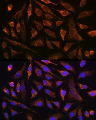 Immunocytochemistry/ Immunofluorescence: MMP-13 Antibody (8L8Q1) [NBP3-15346]