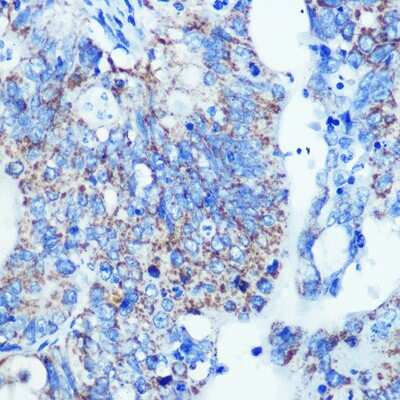 Immunohistochemistry-Paraffin: MMP-13 Antibody (8L8Q1) [NBP3-15346]