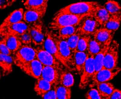 Immunocytochemistry/ Immunofluorescence: MMP-13 Antibody (JF0893) [NBP2-66954]