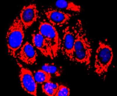 Immunocytochemistry/ Immunofluorescence: MMP-13 Antibody (JF0893) [NBP2-66954]