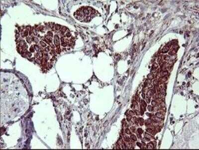 Immunohistochemistry: MMP-13 Antibody (OTI2D8) - Azide and BSA Free [NBP2-72740]