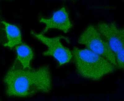 Immunocytochemistry/ Immunofluorescence: MMP-14/MT1-MMP Antibody (3-F7) [NBP2-67415]
