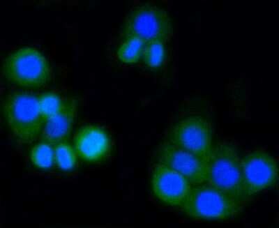 Immunocytochemistry/ Immunofluorescence: MMP-14/MT1-MMP Antibody (3-F7) [NBP2-67415]