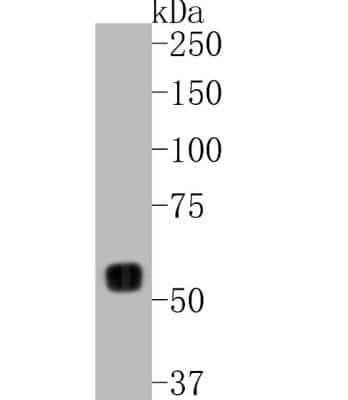Western Blot: MMP-14/MT1-MMP Antibody (3-F7) [NBP2-67415]