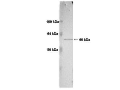 Western Blot: MMP-14/MT1-MMP Antibody (3G4.2)BSA Free [NBP2-29735]