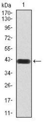 Western Blot: MMP-14/MT1-MMP Antibody (6A11D1)BSA Free [NBP2-52512]